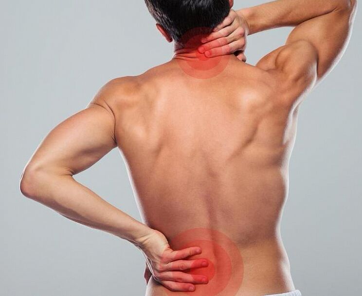 Ein Mann hat Osteochondrose der Wirbelsäule